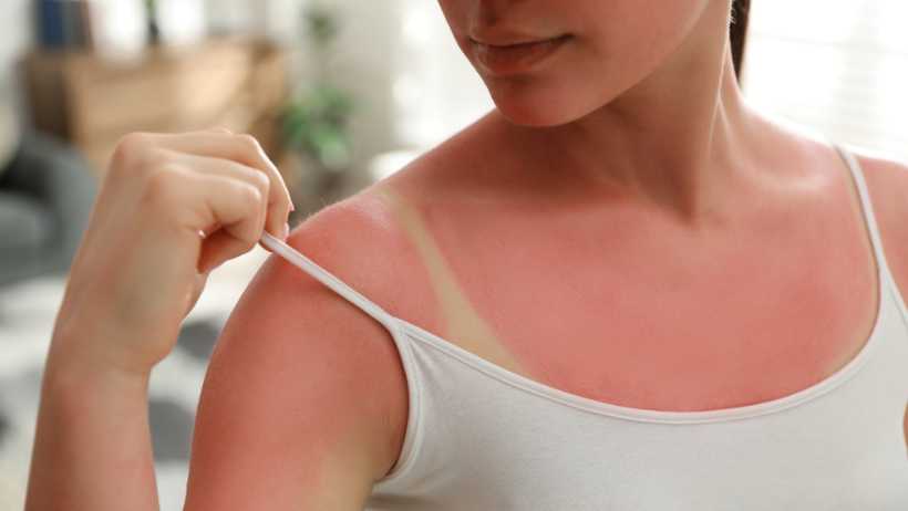 Sun Rash - What Is It and How UV Protective Clothing Can Help?